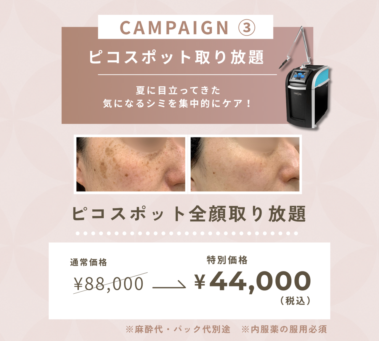 キャンペーン
