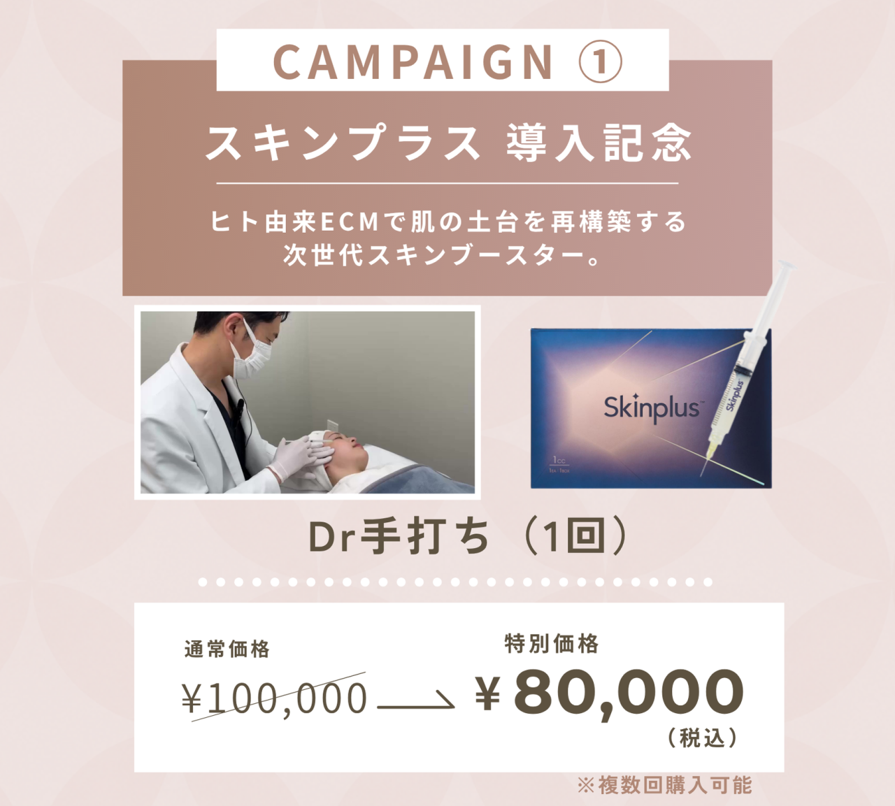 キャンペーン